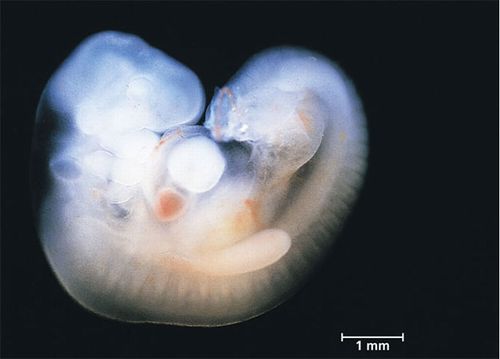 embryo_human_002.JPG