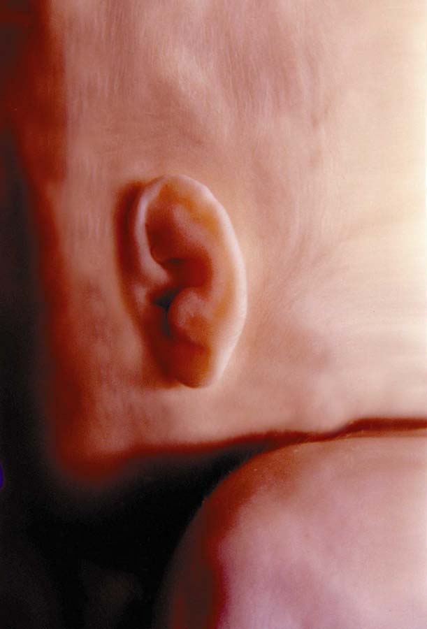 fig04ear5mos.jpg