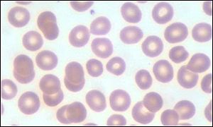 _864446_red_blood_cells300.jpg