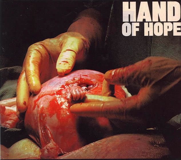 HandofHope.jpg