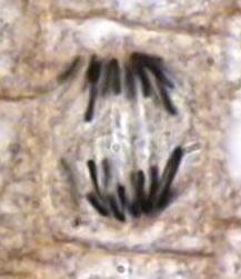 anaphase2.jpg